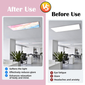 ANGSYLTH magnetic light covers install without tools in a clinic