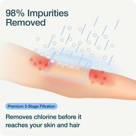 MyHalos high-pressure filtered shower head maintains strong flow with impurity reduction